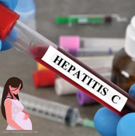 ¿Se puede tratar la hepatitis C durante el embarazo? ¿Puede la hepatitis C causar defectos de nacimiento?