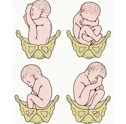 posiciones feto