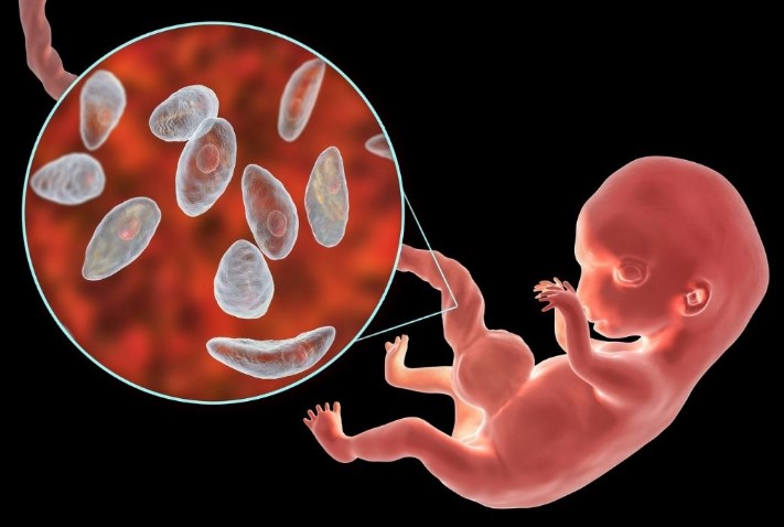 Toxoplasmosis en el embarazo: prevención, detección y tratamiento