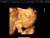 delfina, 22 semanas