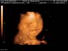 santi, 25 semanas