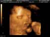 santi, 31 semanas