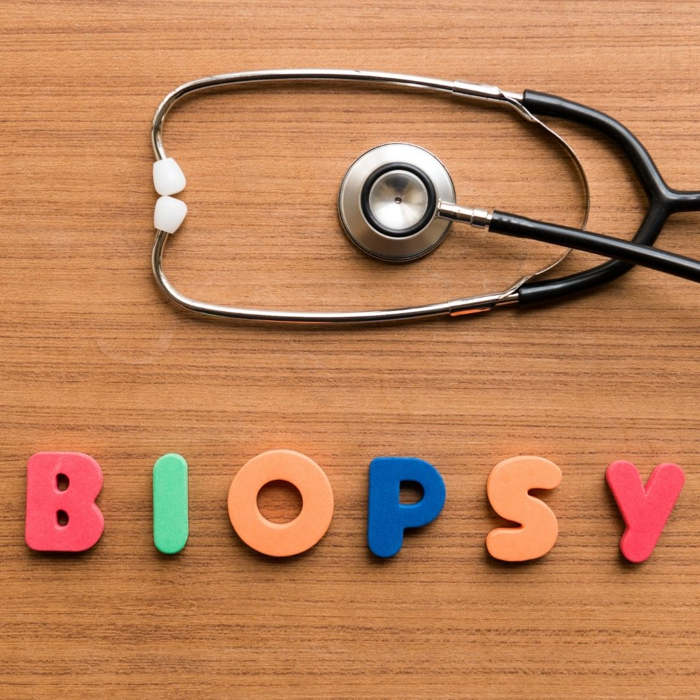 Biopsia de Mama: ¿Qué es? ¿Cómo se hace biopsia de pecho, seno, mama?