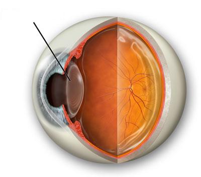 ojos sanos, con el cristalino sano de un paciente no fumador.
