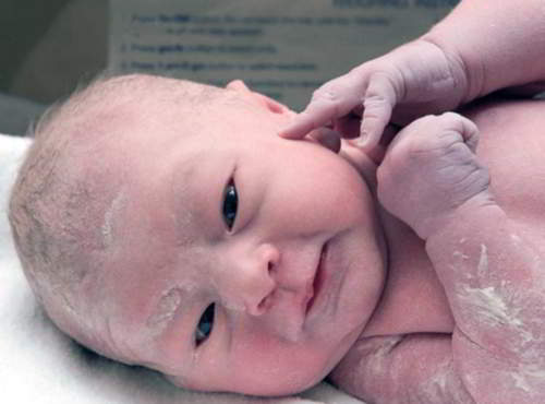 Vérnix caseosa en el recién nacido, qué es y cuándo limpiarla