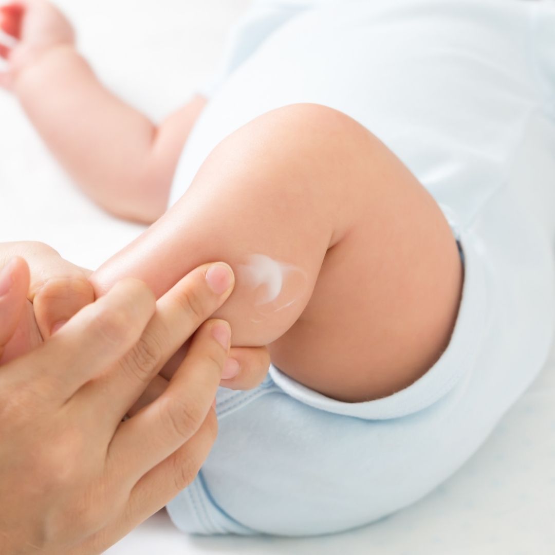 Cuidado de la piel del bebé: lo que hay que saber