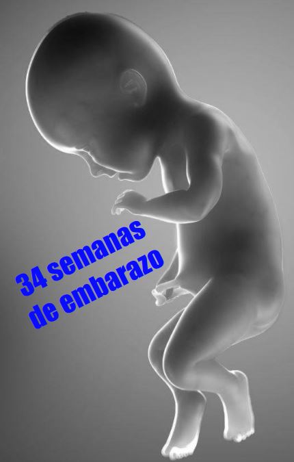 34 semanas gestacion