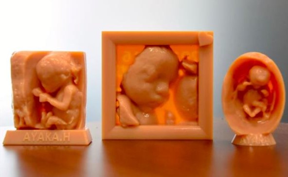 Imágenes de 3d impresas del feto