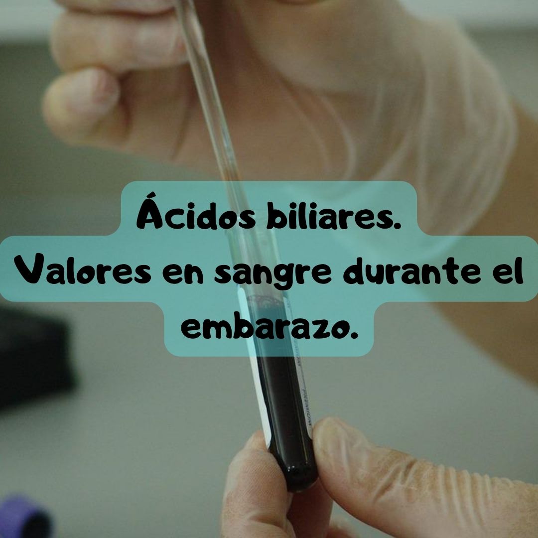 ¿Qué pasa si tengo los Ácidos biliares alto o bajo? Ácidos biliares durante el embarazo, análisis de sangre