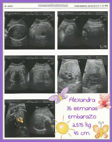 alexandra 35 semanas