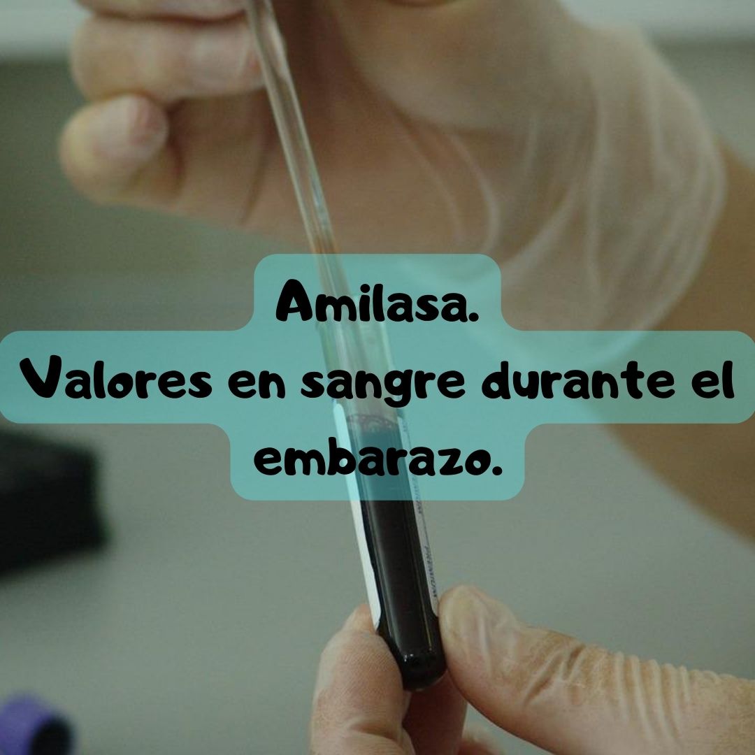 ¿Qué pasa si tengo la Amilasa alta? Amilasa durante el embarazo, análisis de sangre