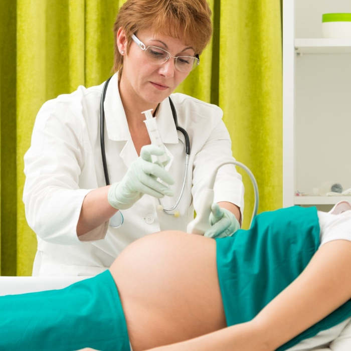 amniocentesis prueba, preguntas frecuentes