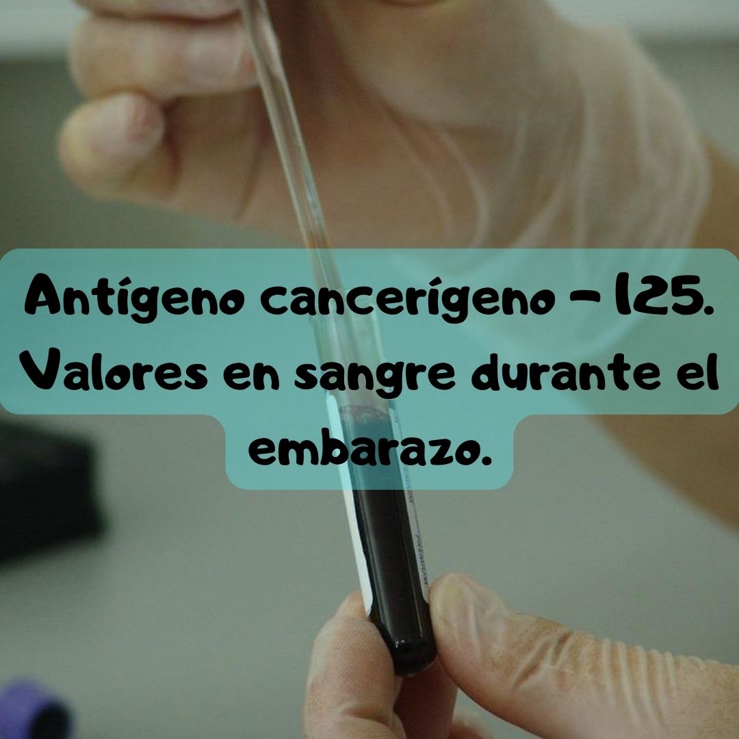 ¿Qué pasa si tengo el antígeno cancerígeno 125 alto o bajo? Antígeno Cancerígeno 125 durante el embarazo, análisis de sangre