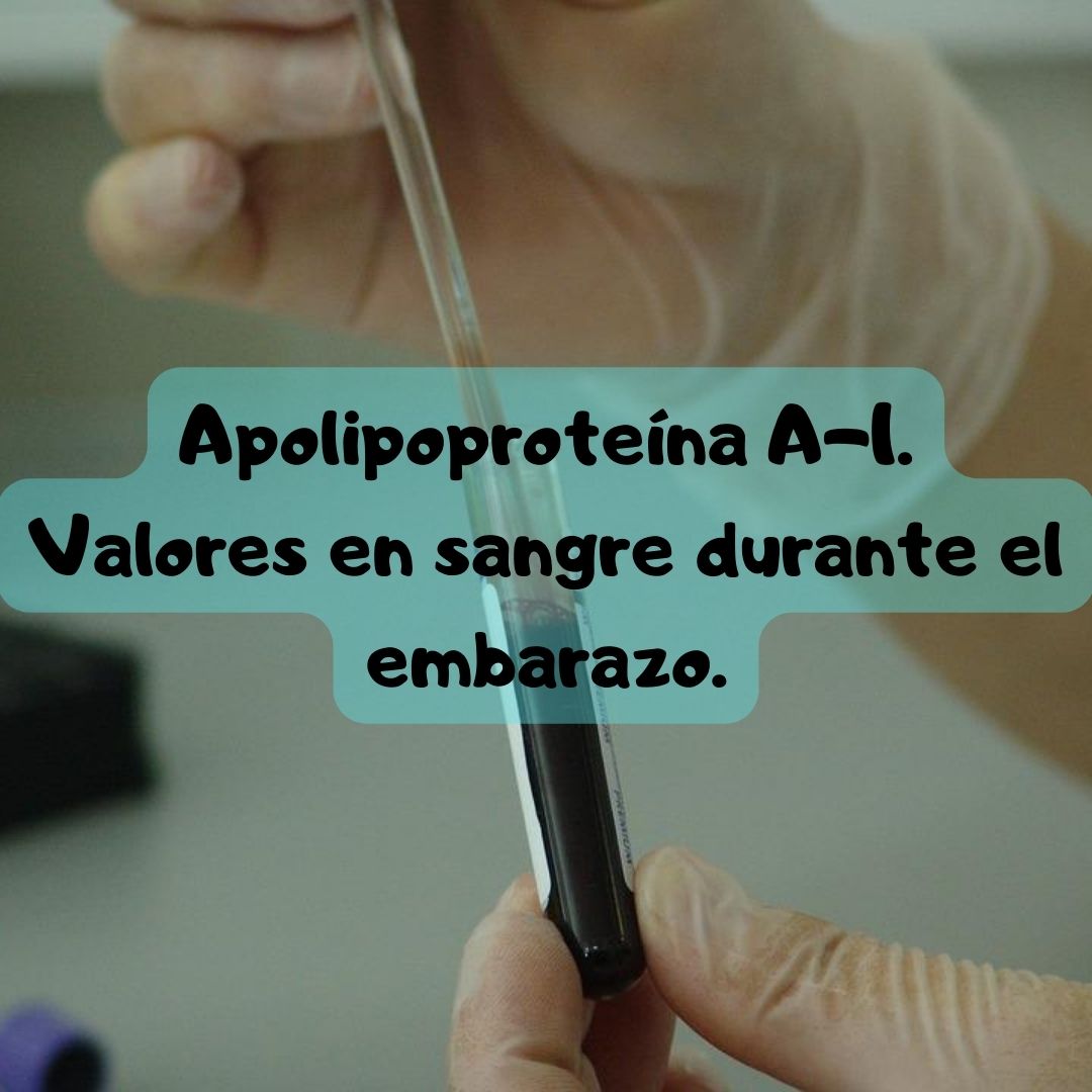 ¿Qué pasa si tengo la Apolipoproteína A-1 alta o baja? Apolipoproteína A-1 durante el embarazo, análisis de sangre