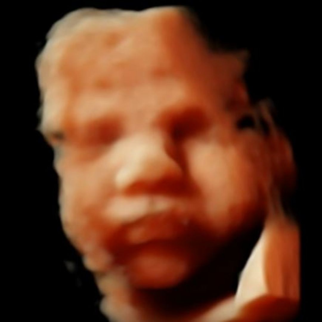 eco 5D, feto 38 semanas, qué puede escuchar el bebé en el vientre materno