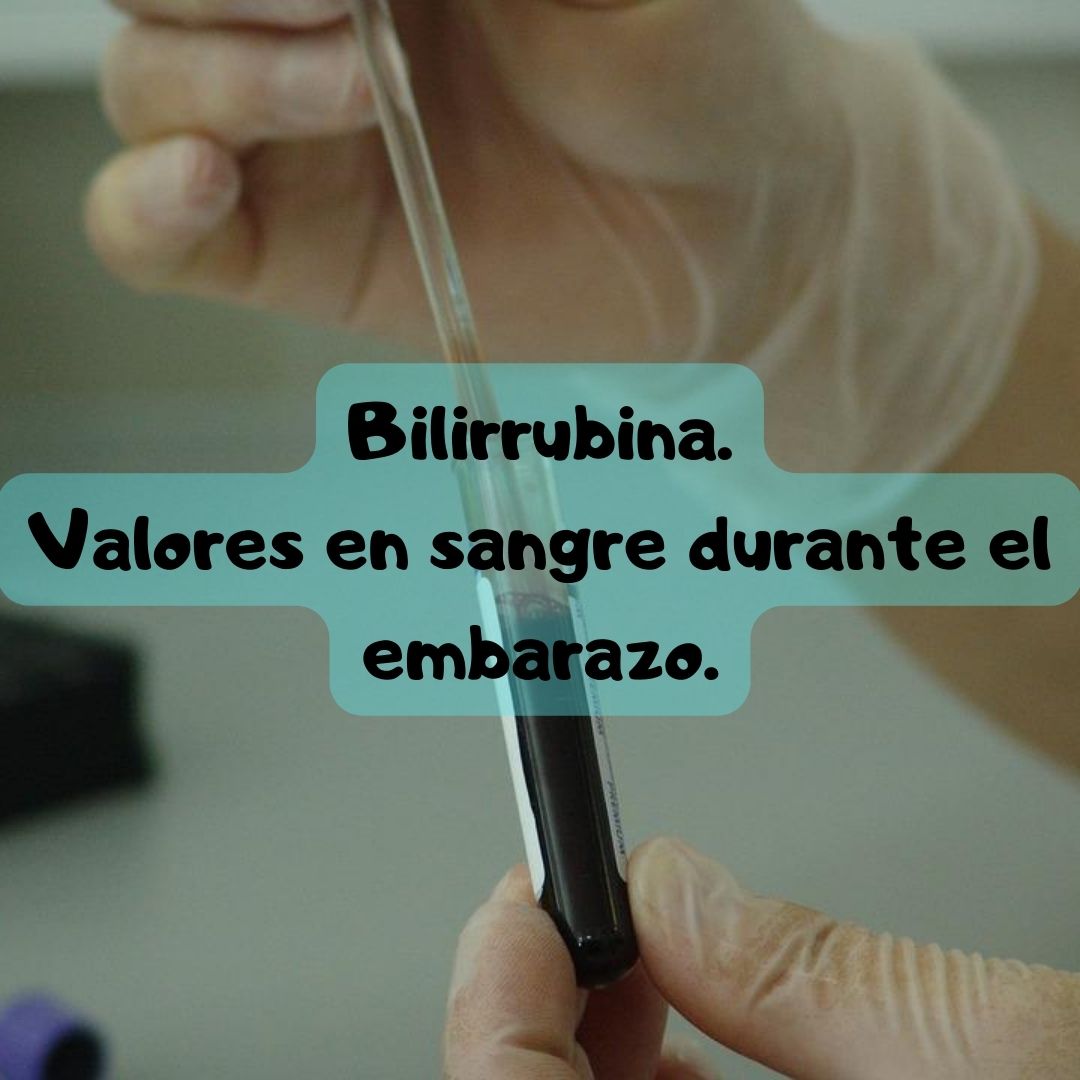 ¿Qué pasa si tengo Bilirrubina alta o baja? Bilirrubina durante el embarazo, análisis de sangre