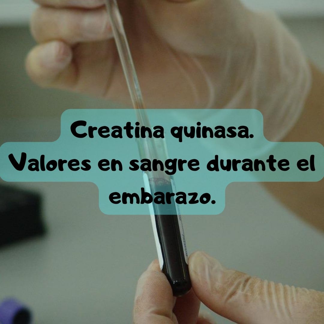 ¿Qué pasa si tengo la Creatina quinasa alta o baja? Creatina quinasa durante el embarazo, análisis de sangre