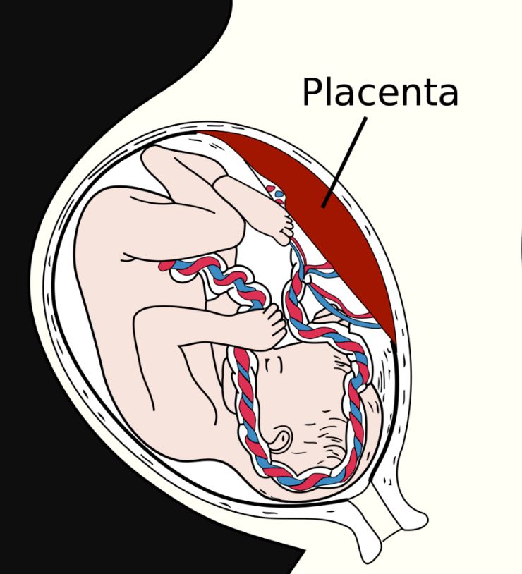 placenta desprendimiento