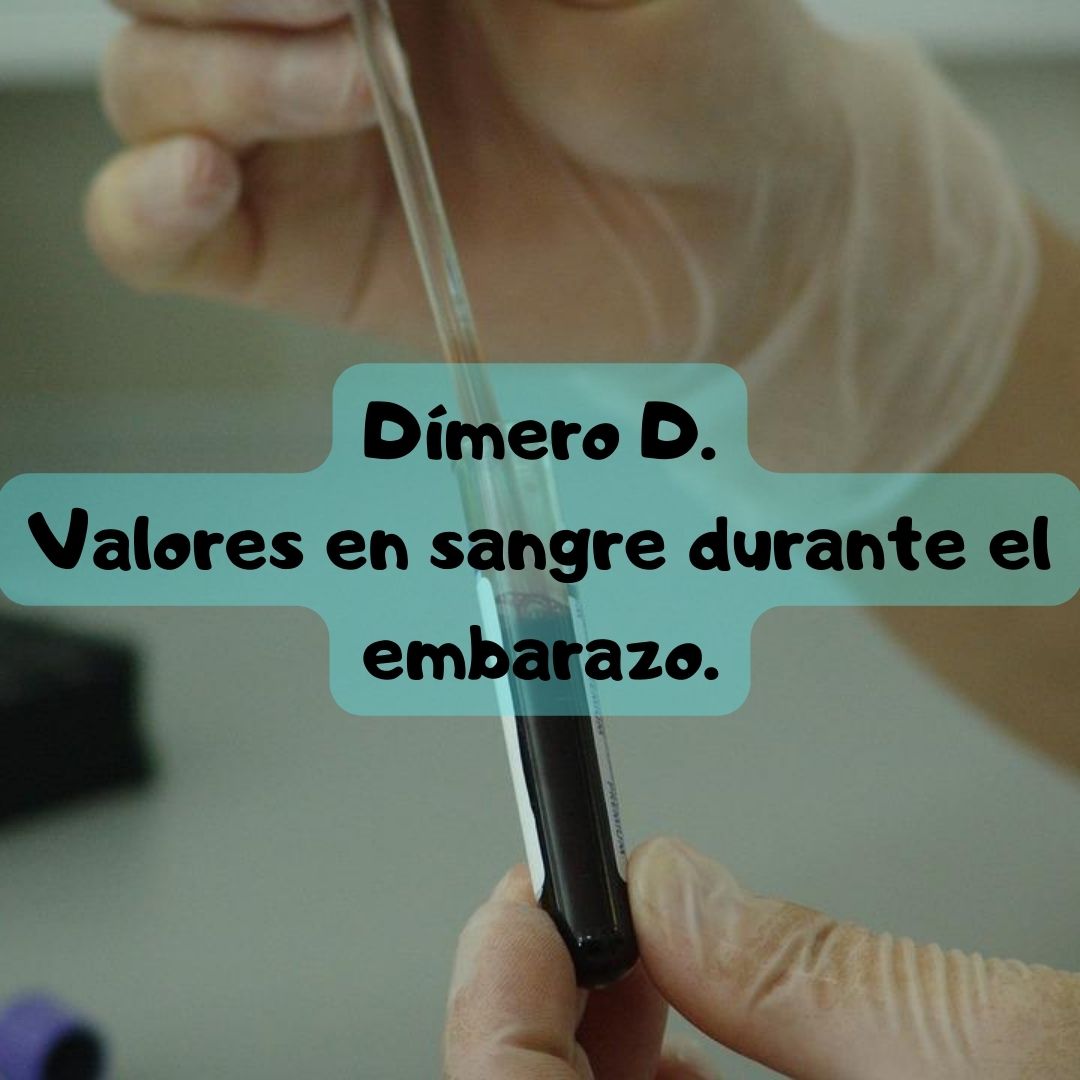 ¿Qué pasa si tengo el Dímero D alto o bajo? Dímero D durante el embarazo, análisis de sangre