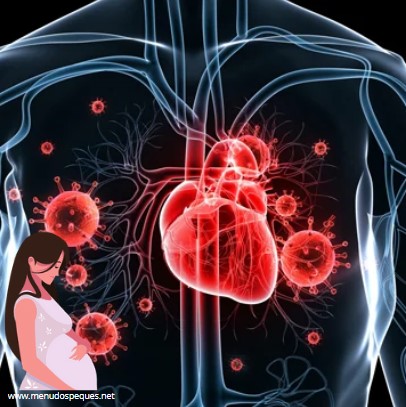 Endocarditis durante el embarazo: Síntomas y complicaciones