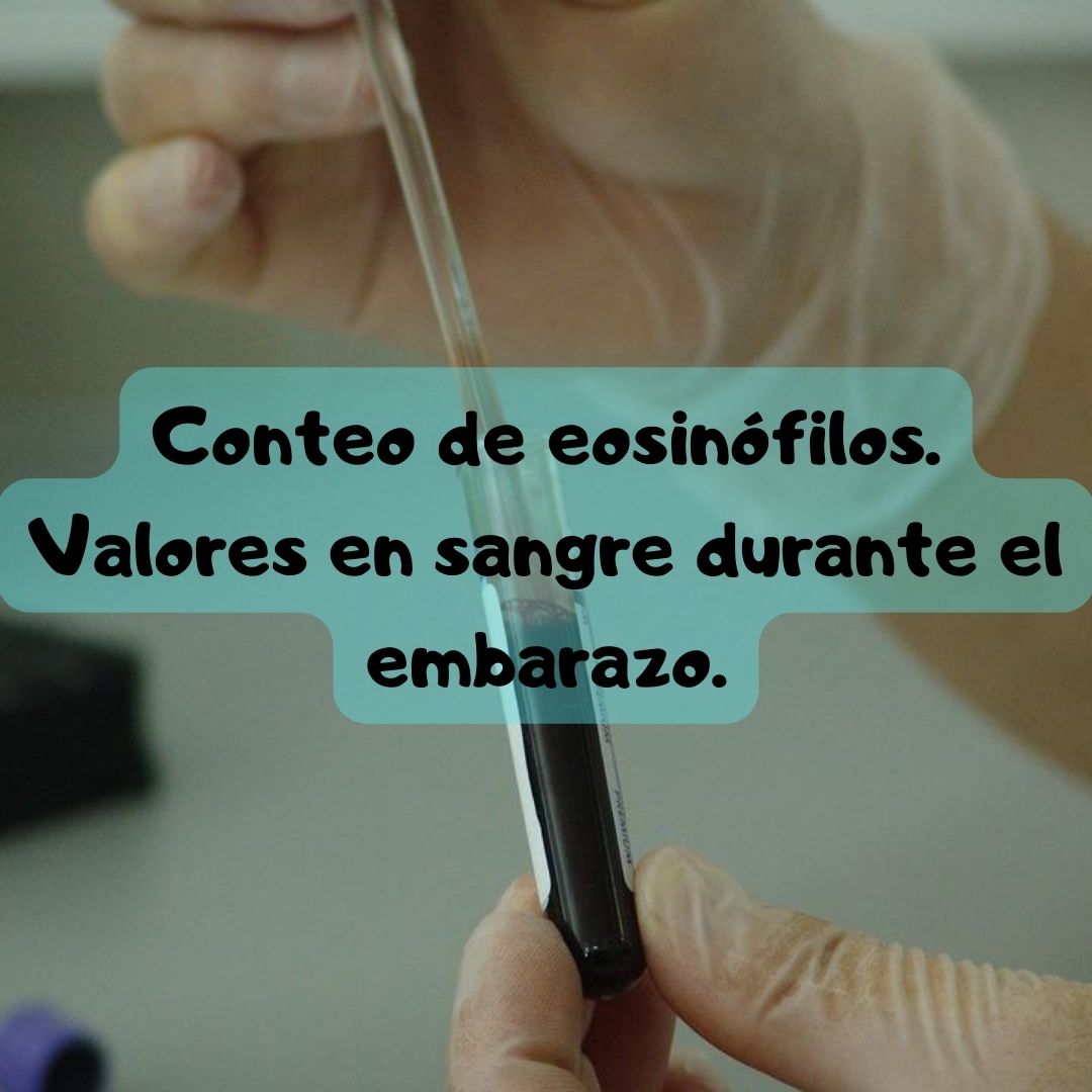 ¿Qué pasa si tengo el recuento de eosinófilos alto o bajo? Conteo de eosinófilos durante el embarazo, análisis de sangre