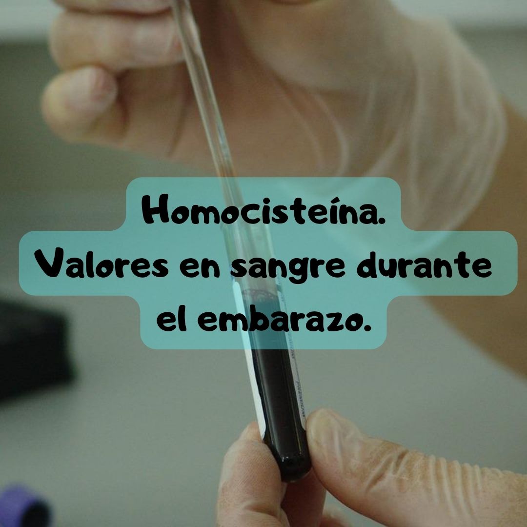 ¿Qué pasa si tengo homocisteína alta o baja? Niveles de homocisteína durante el embarazo, análisis de sangre