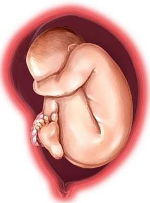 parto nalgas vaginal cesarea
