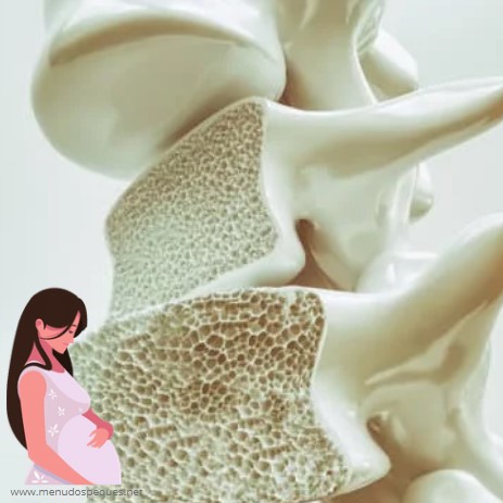 ¿Puede la osteoporosis afectar al embarazo? ¿Qué causa la osteoporosis durante el embarazo?