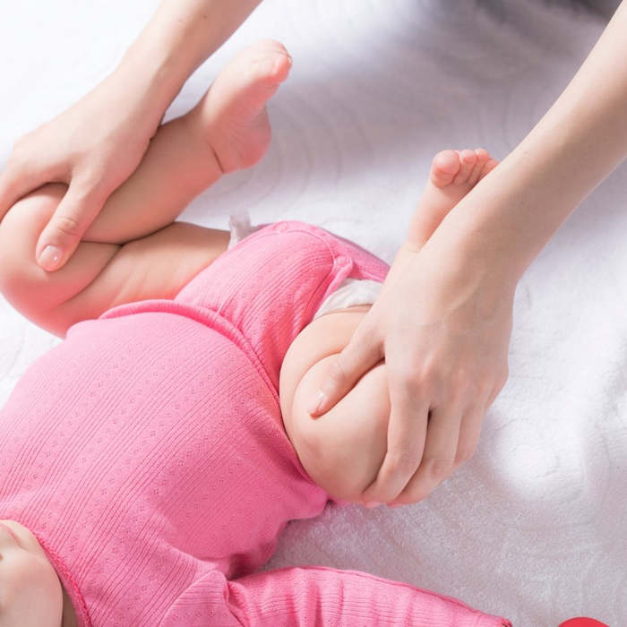 ¿Cómo saber si un bebé tiene displasia de cadera?