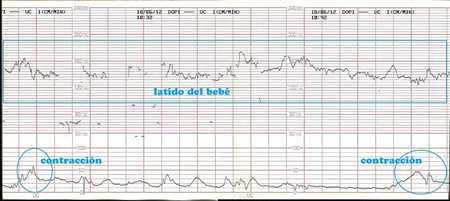 test basal