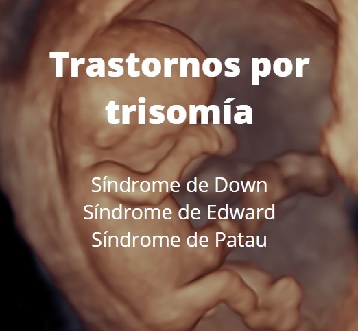 Trastornos por trisomía, Síndrome de Down, Síndrome de Edward, Síndrome de Patau