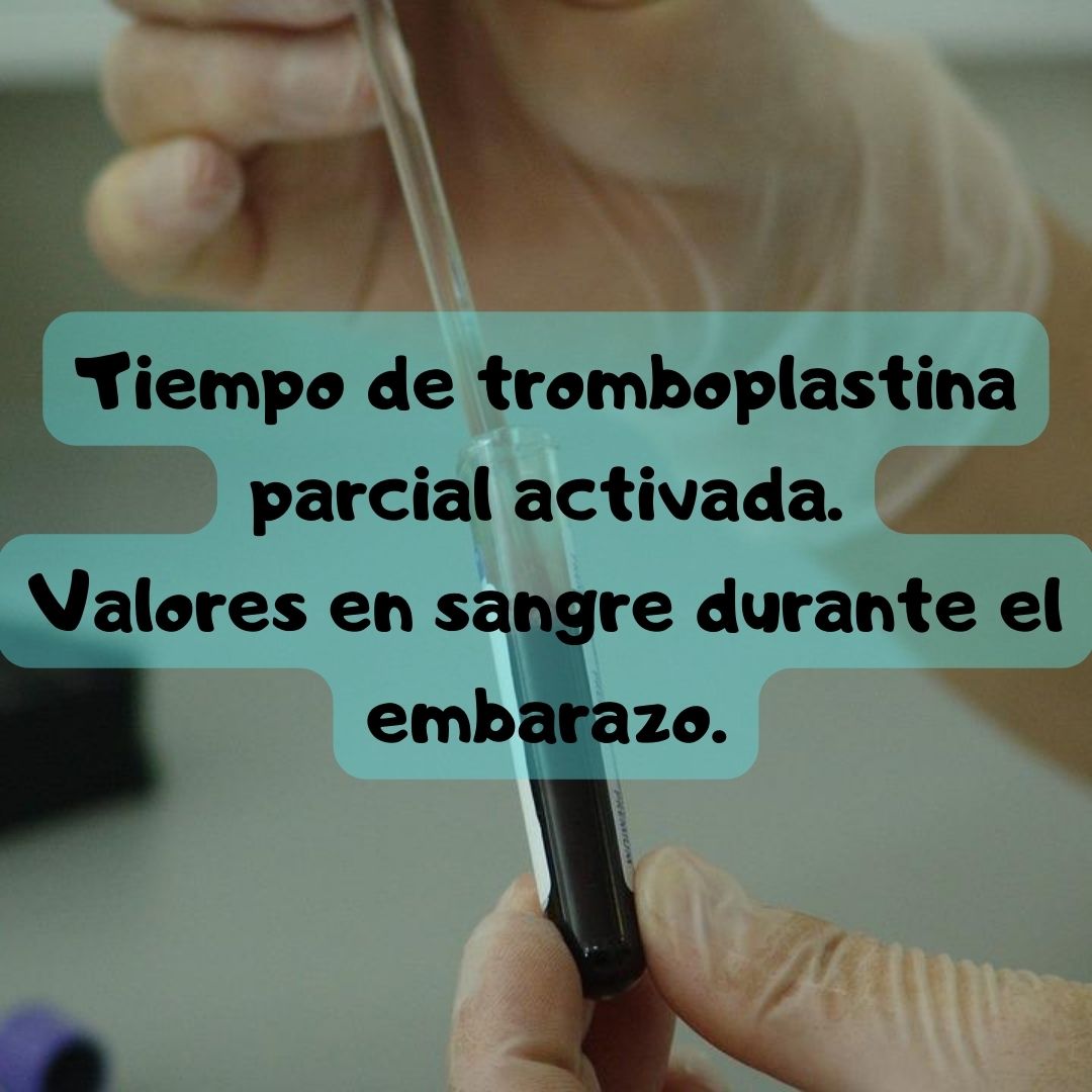 ¿Qué pasa si tengo la Tiempo de tromboplastina parcial activada en el embarazo? Tiempo de tromboplastina parcial activada durante el embarazo, análisis de sangre