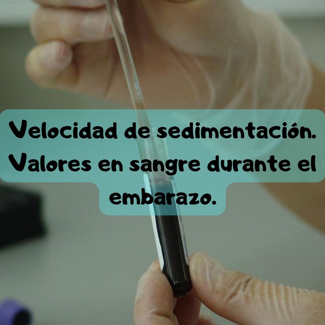 ¿Qué pasa si tengo la Velocidad de sedimentación globular alta o baja? Velocidad de sedimentación globular durante el embarazo, análisis de sangre