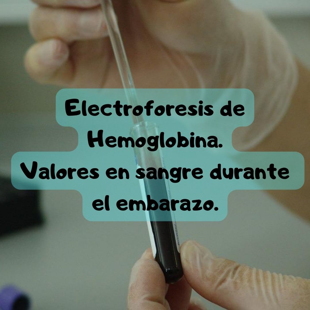 ¿Qué pasa si tengo Electroforesis de hemoglobina alta o baja? Niveles de Electroforesis de hemoglobina durante el embarazo, análisis de sangre