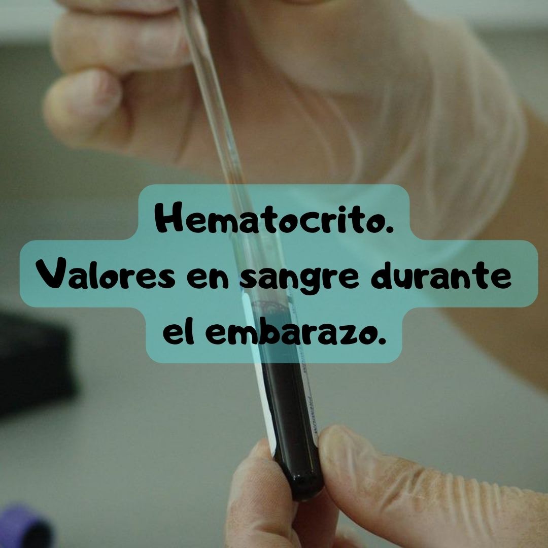 ¿Qué pasa si tengo hematocrito alto o bajo? Niveles de hematocrito durante el embarazo, análisis de sangre