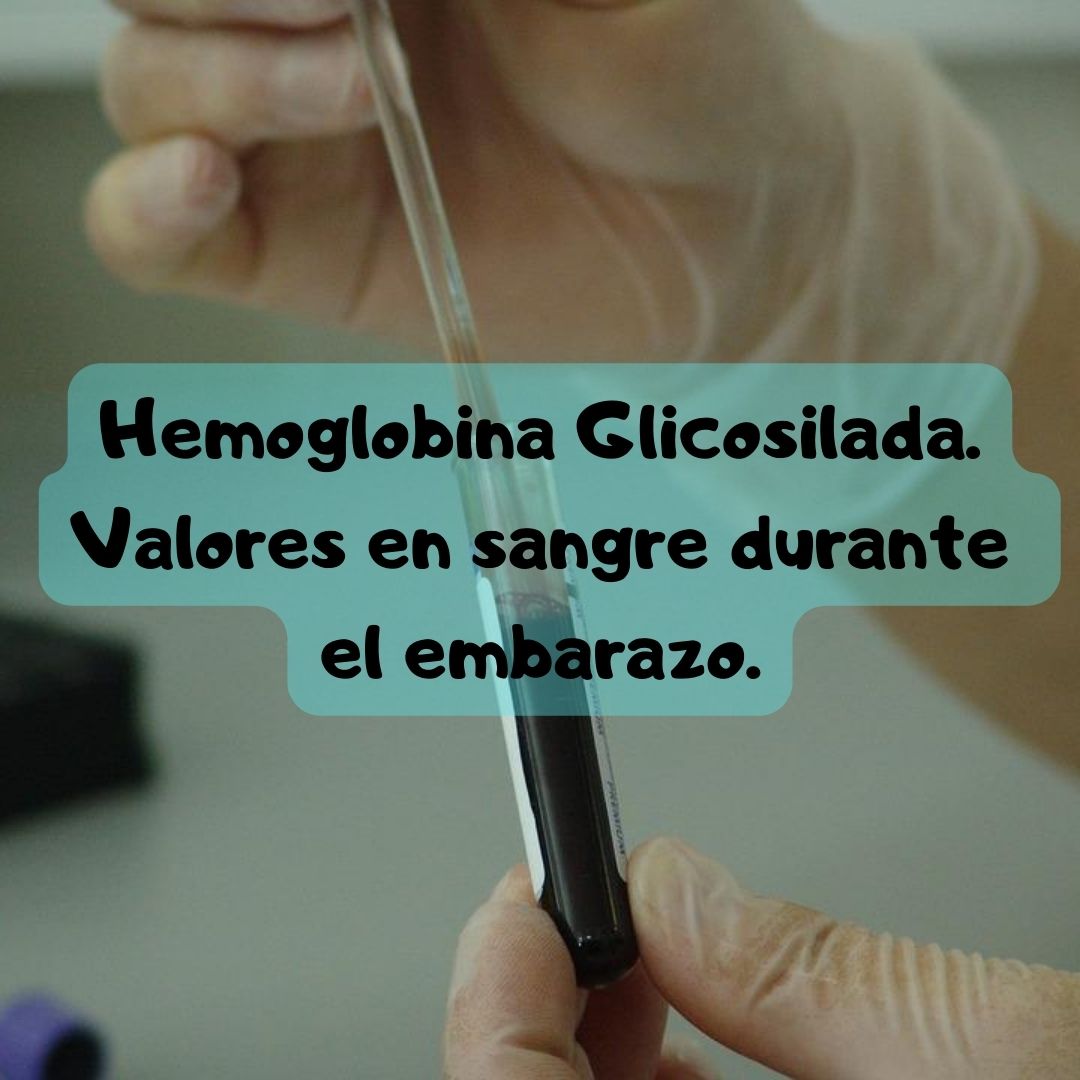 ¿Qué pasa si tengo Hemoglobina glucosilada alta o baja? Niveles de Hemoglobina glucosilada durante el embarazo, análisis de sangre