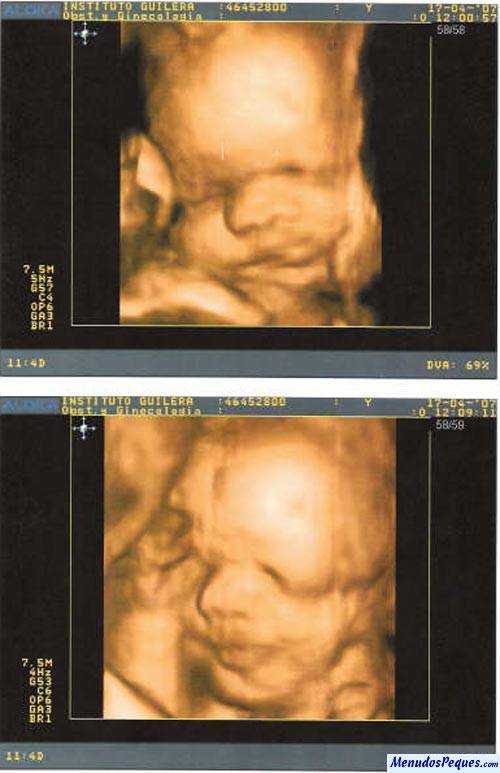 edurne ecos 4d 30 semanas