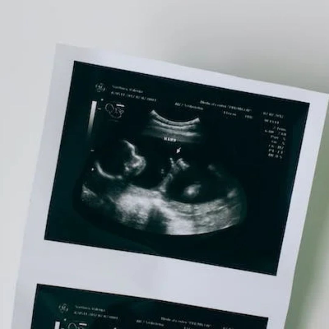 embrion, feto, ecografia, Cuentos para niños, embarazo, cuento para explicar a los niños el embarazo