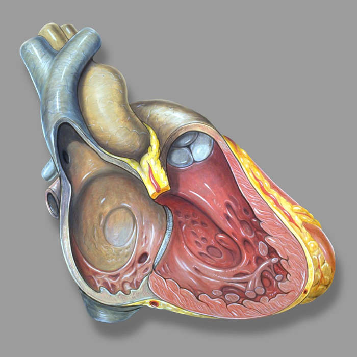 - ¿Qué son las Cardiopatías Congénitas?