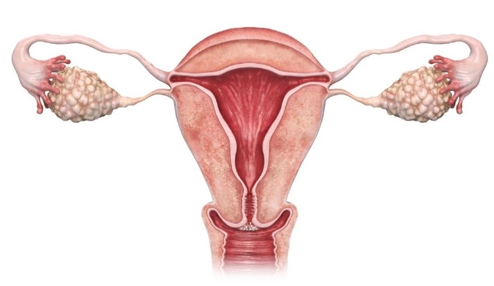 displesia cervical, displasia cervical útero