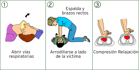 reanimacion-cardiopulmonar