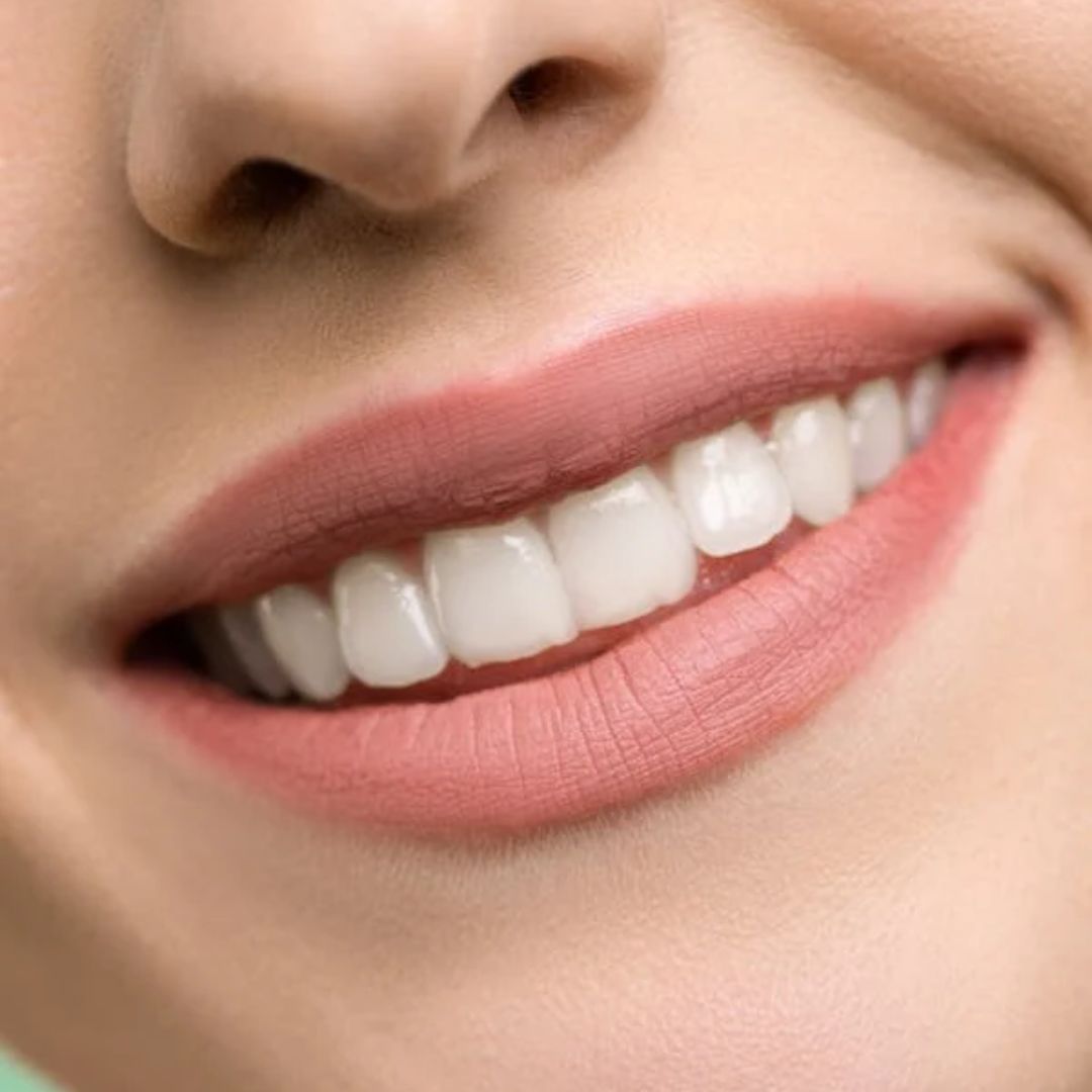 boca, dientes, sonrisa, enfermedades bucodentales, Salud Bucodental