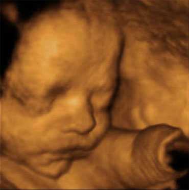 feto con 29ª y 30ª semana (31 a 32 semanas de embarazo)