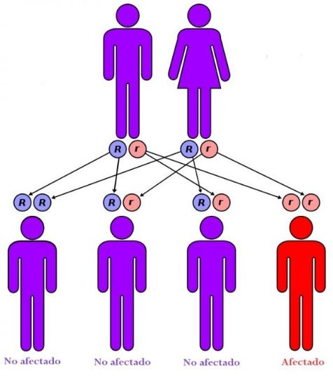 abetalipoproteinemia