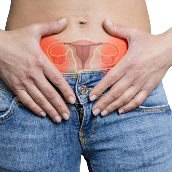 Cáncer de Ovario: Qué es, Tipos y Fases