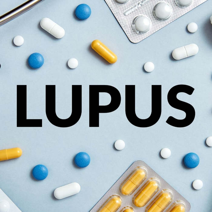 ¿Cuáles son los primeros síntomas del lupus?  ¿Es el lupus una enfermedad grave?