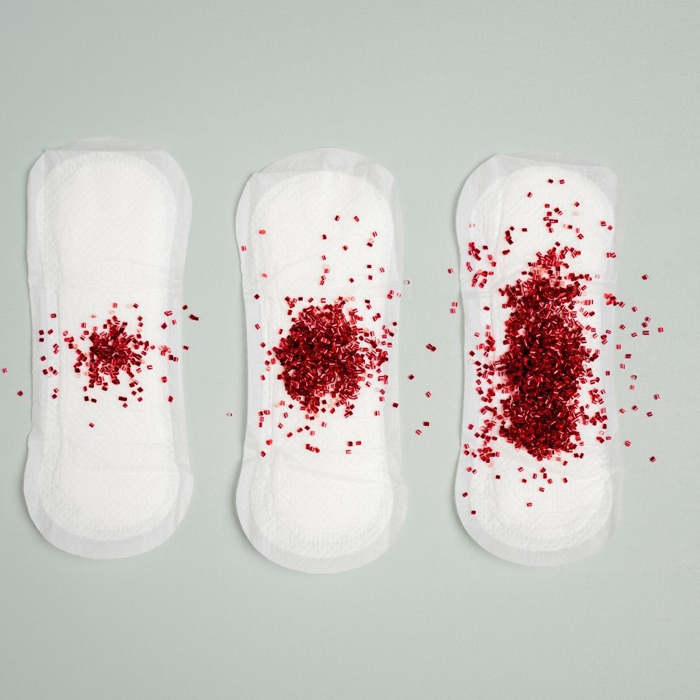 sangrado anormal menstruacion
