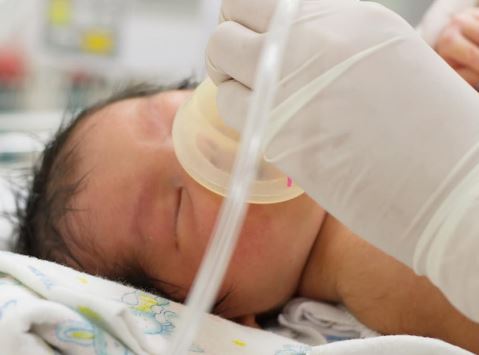 sdr - Síntomas y tratamiento del Síndrome de dificultad respiratoria en bebés