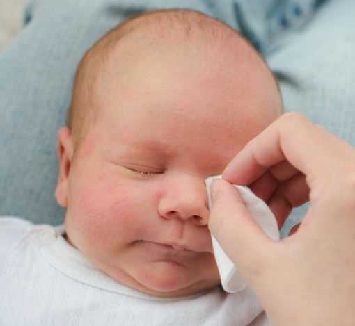 conjuntivitis obstruccion lacrimal bebé