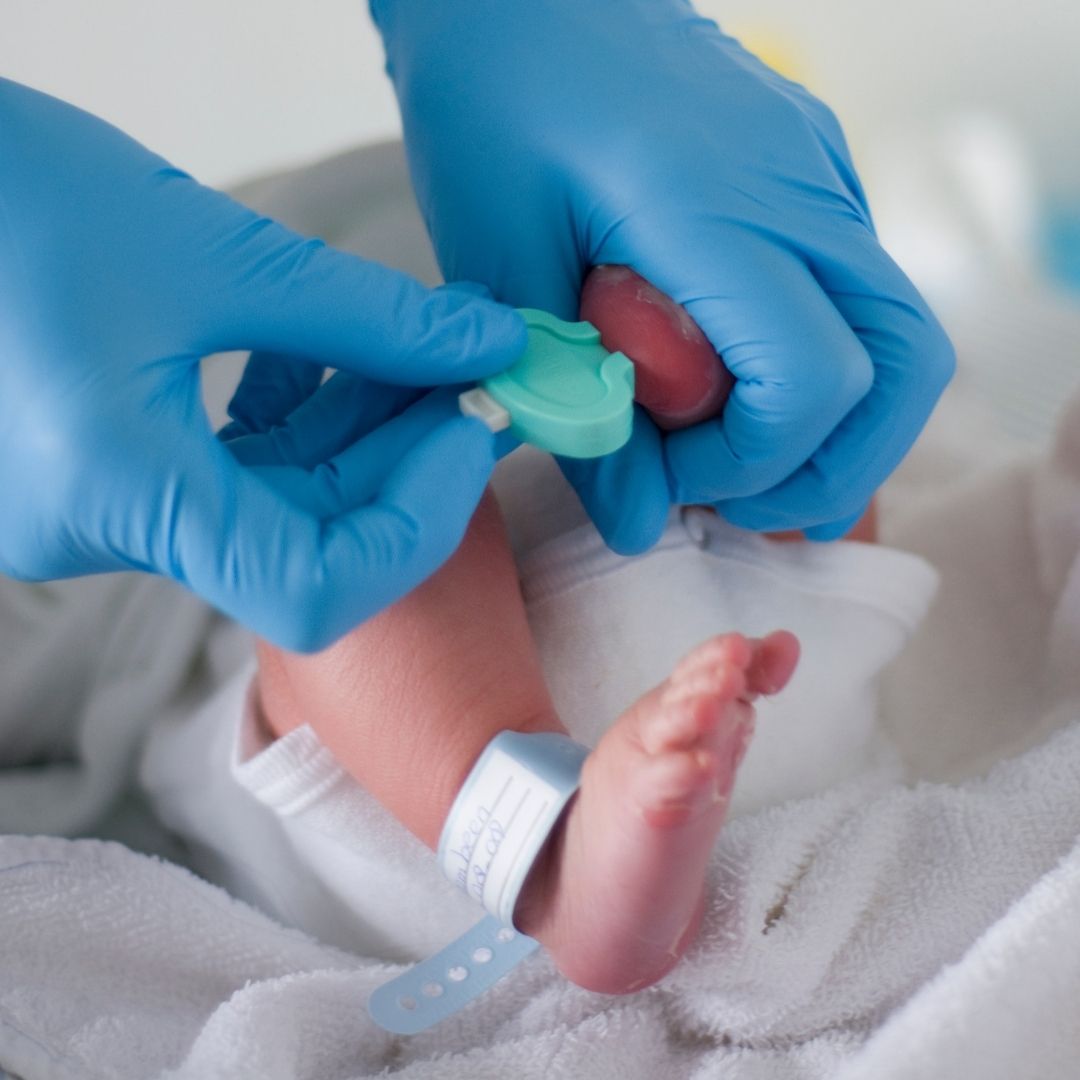 ¿Qué enfermedades detecta la prueba del talón en bebés?  ¿Cómo se llama la prueba del talón en recién nacidos?